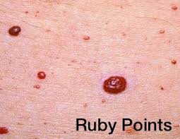 Ruby Points